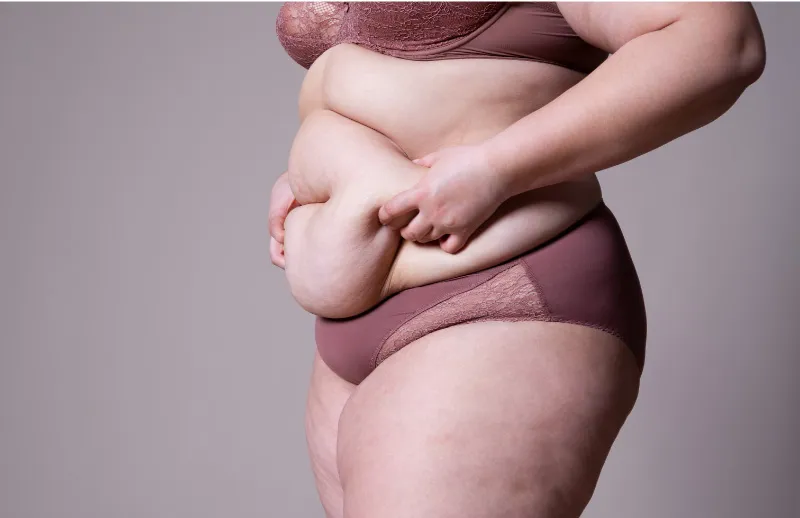 Intimacy, Self-Esteem, and Relationships: Navigating Love and Body Image with Lipedema