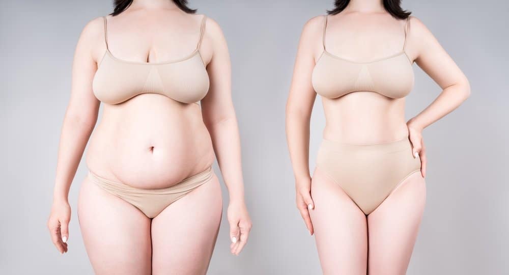 Compression Maintenance and Treatment for Lipedema