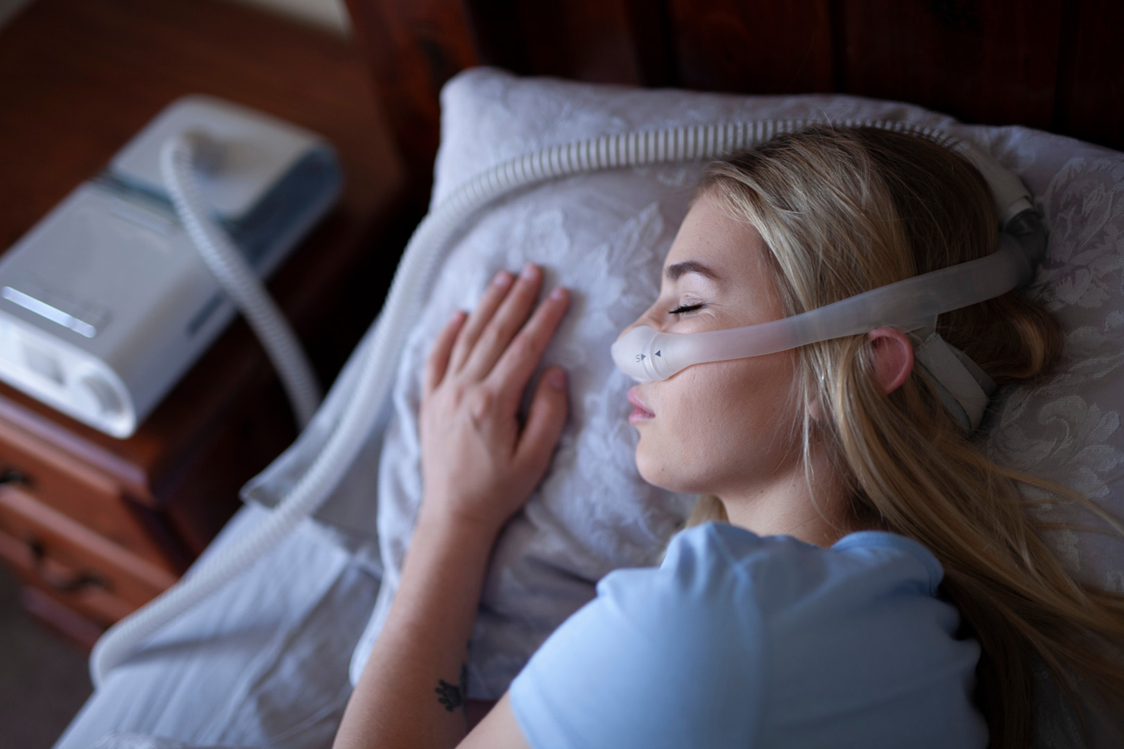 Prevalence of Sleep Apnea in Patients with Advanced Lipoedema