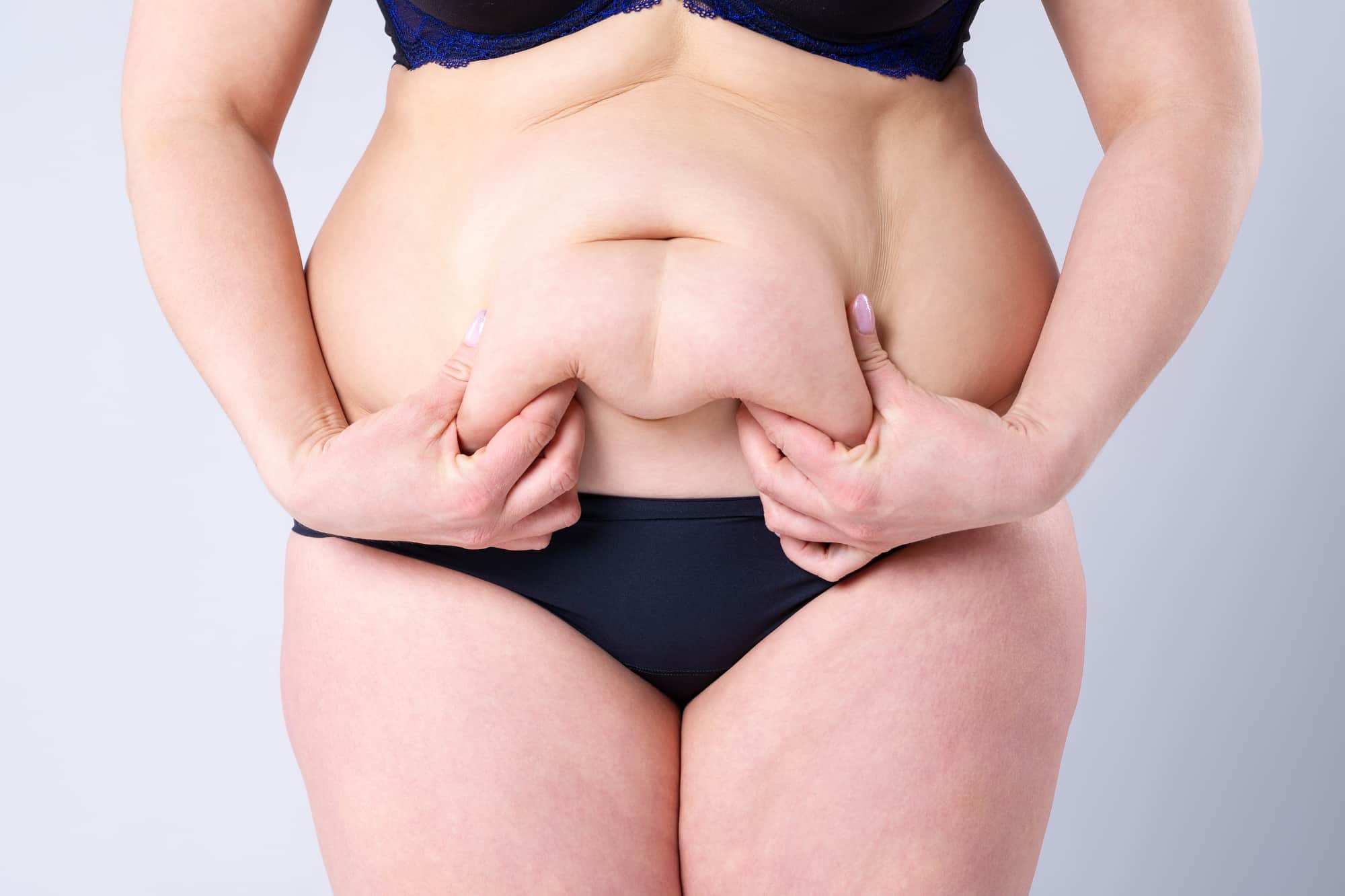 Hard Lumps After Lipedema Surgery? Causes, Concerns, and Care Strategies