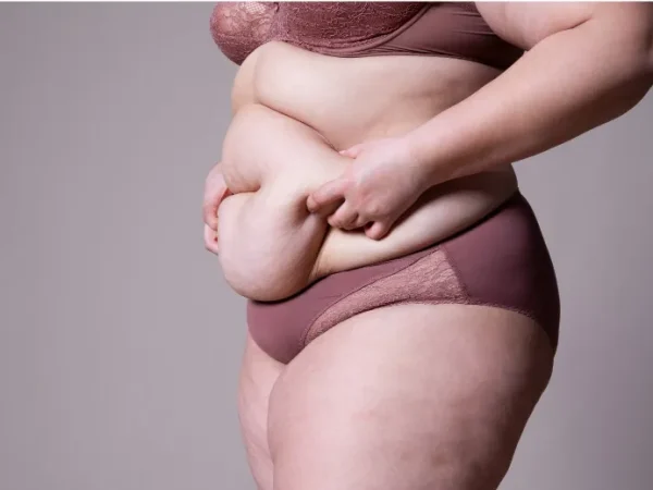 Appealing a Lipedema Insurance Denial