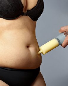 Lipedema and Body Image: Causes, Emotional Impact, and Treatment Options