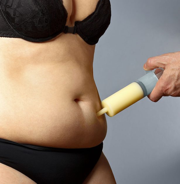 Lipedema and Body Image: Causes, Emotional Impact, and Treatment Options