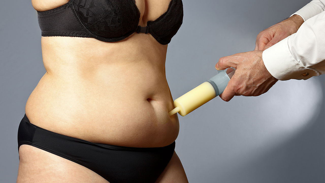 Tumescent Fluid Leakage After Lipedema Liposuction – What to Know