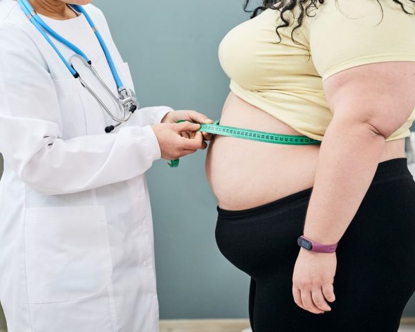 Stage 1 Lipedema: Definition, Symptoms & Early Intervention Strategies