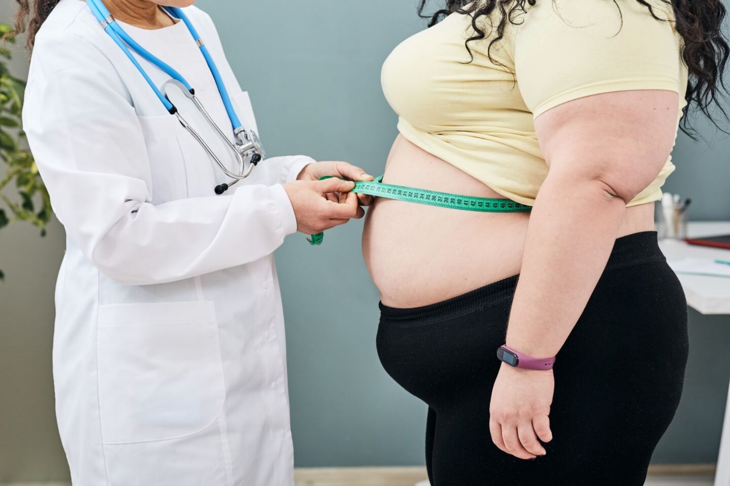 Stage 1 Lipedema: Definition, Symptoms & Early Intervention Strategies