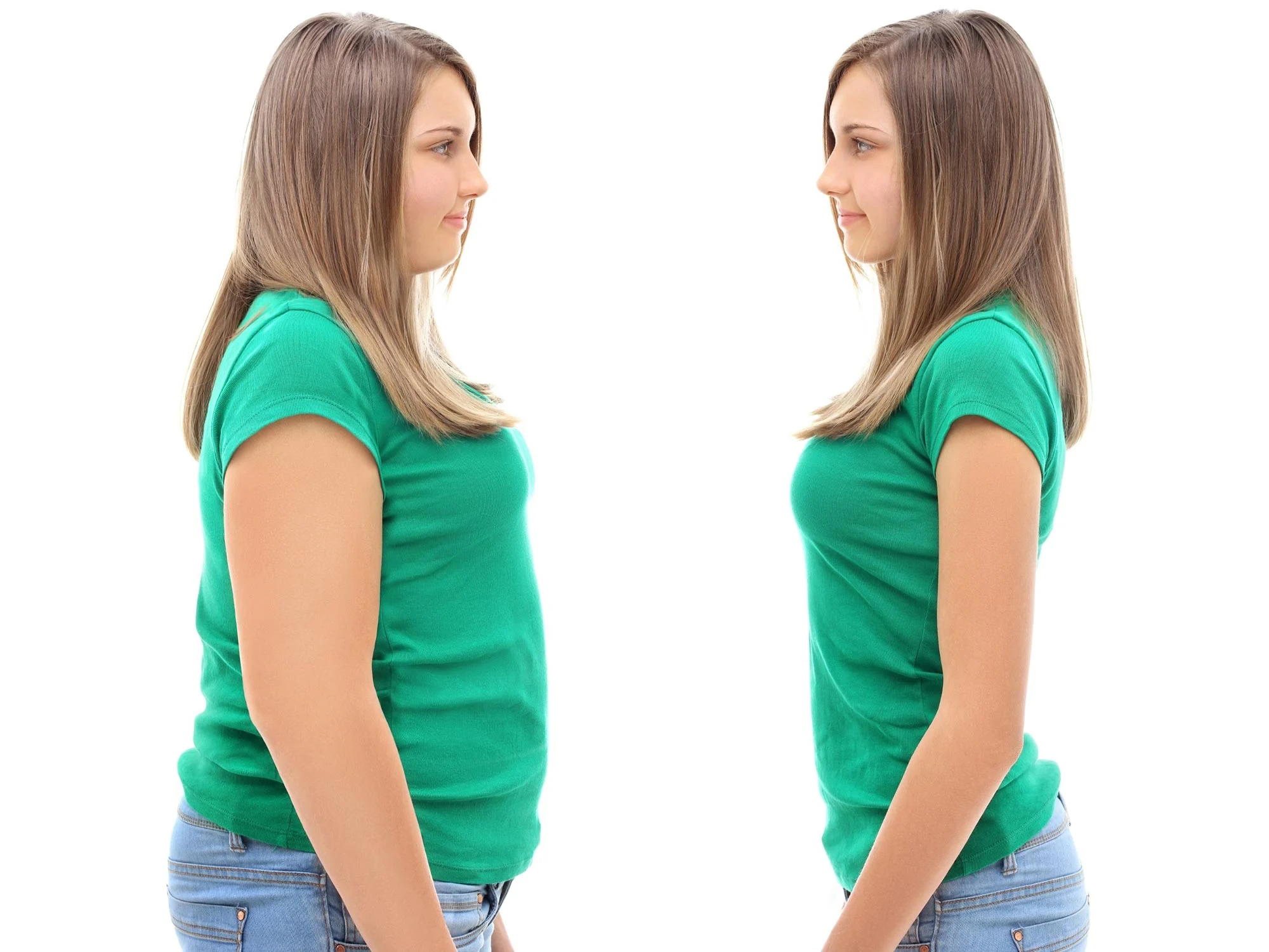 Lipedema: Understanding Genetic Factors and Family History