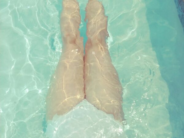 Lipedema and Humid Weather: Managing Swelling and Discomfort