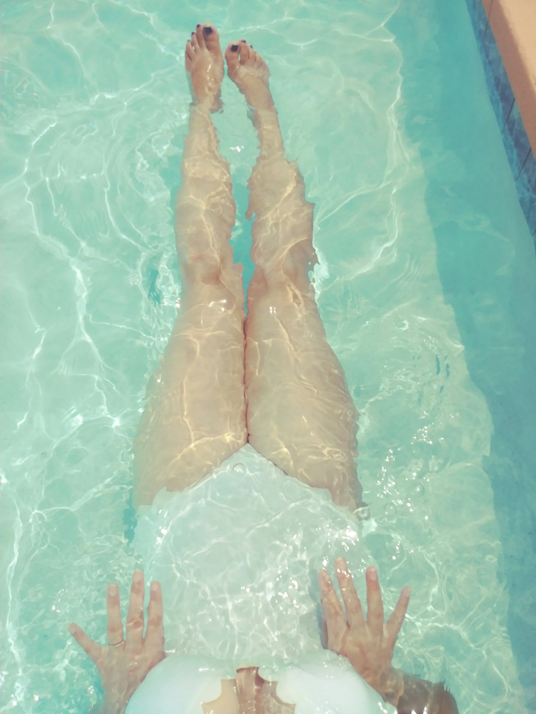 Lipedema and Humid Weather: Managing Swelling and Discomfort