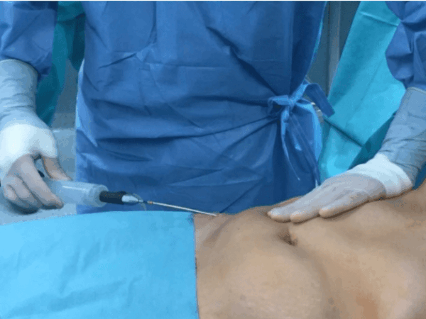 How to Choose the Right DSurgeon for You