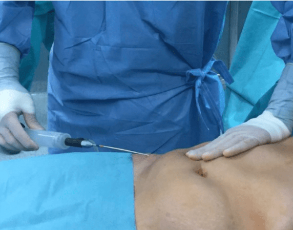 How to Choose the Right DSurgeon for You