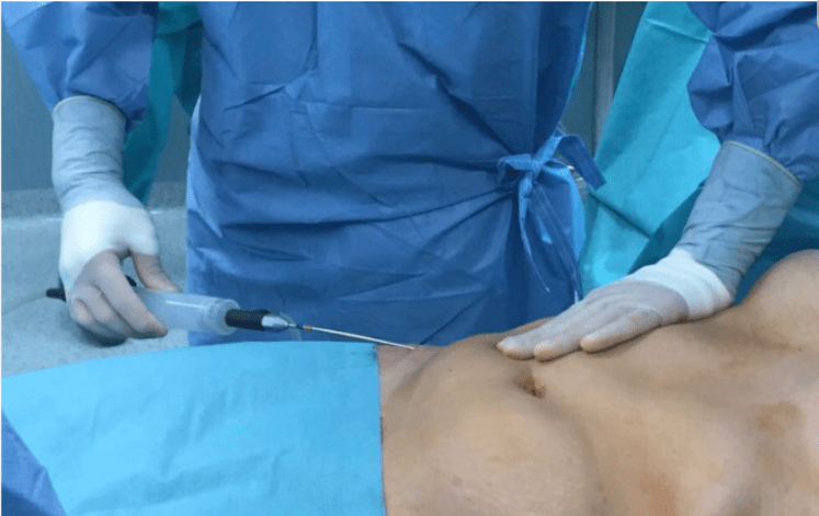 How to Choose the Right DSurgeon for You