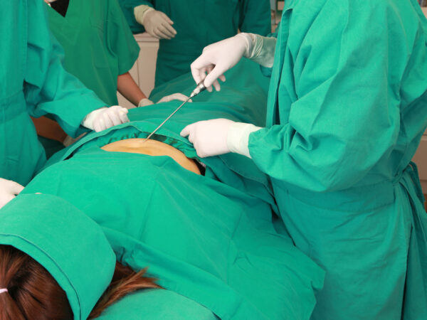Lipedema Surgery vs Weight Loss: Comparing Effectiveness, Pre-Surgery Weight Management, and Lifestyle Strategies