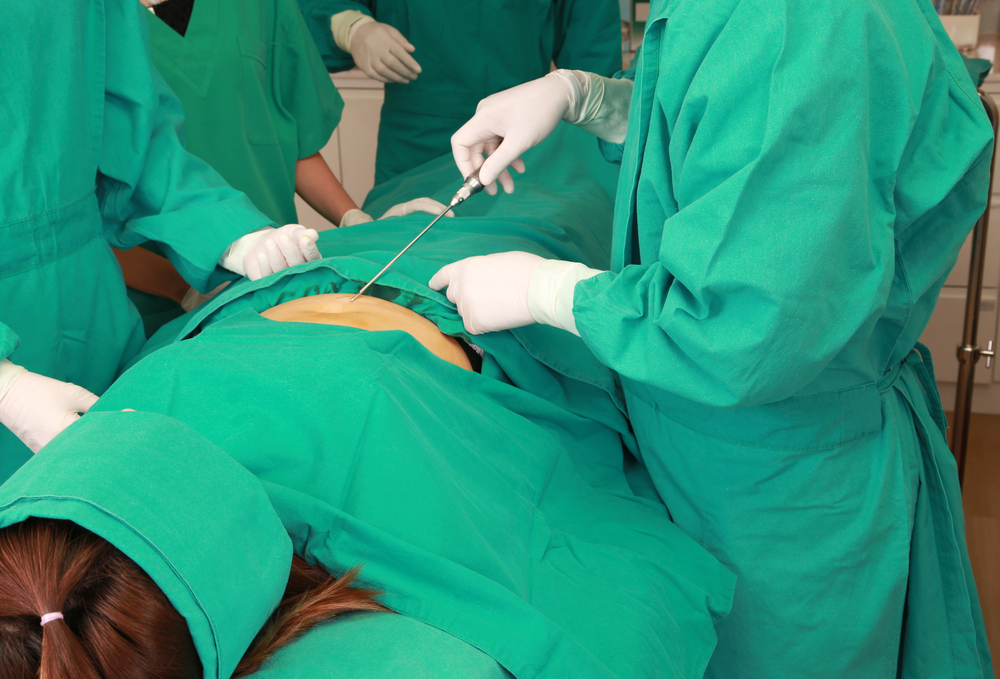 Lipedema Surgery vs Weight Loss: Comparing Effectiveness, Pre-Surgery Weight Management, and Lifestyle Strategies